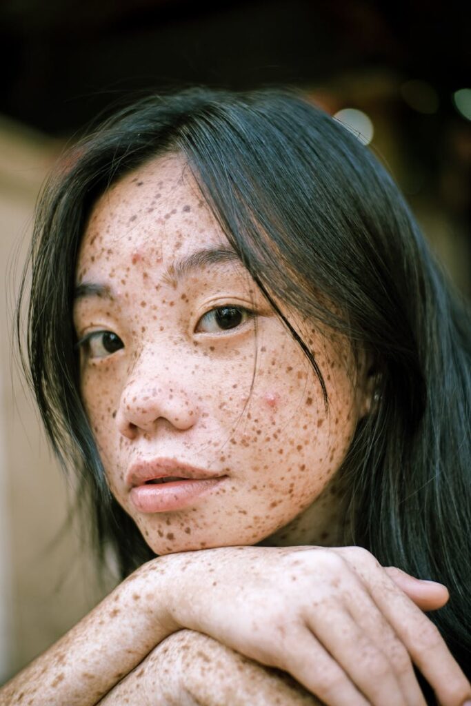 Intimate portrait highlighting the unique freckles and natural beauty of a young woman.